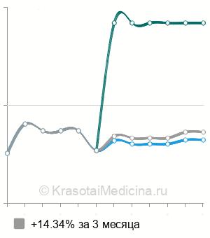 Средняя стоимость МРТ молочных желез в Красноярске